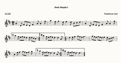 Denis Murphy's Slide